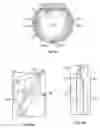 Fig. 07 - Transcutaneous analyte sensors, applicators therefor, and associated methods