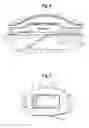 Fig. 04 - Graft prosthesis with pocket for microsystem
