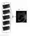 Fig. 01 - Method and apparatus visualizing a medical object