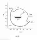 Fig. 06 - Method for generating a 3D data set complete in the central layer for volume reconstruction and cone-beam C-arm X-ray apparatus for performing the method