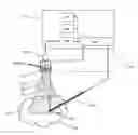Fig. 01 - Ultrasound based tracking