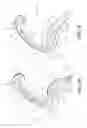 Fig. 09 - Surgical clip