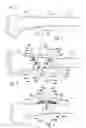 Fig. 02 - Patient-specific cutting guide
