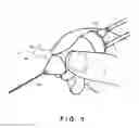 Fig. 02 - Object suction device
