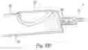 Fig. 09 - Device for chemically assisted dissection