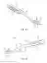 Fig. 02 - Methods and systems for insertion and fixation of implantable devices