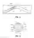 Fig. 08 - Thrombectomy catheter systems