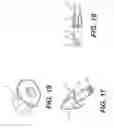 Fig. 06 - Lateral spinous process spacer