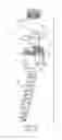 Fig. 02 - Spinal screw insertion devices and methods