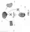 Fig. 02 - Method and deployable multi-spine apparatus for catheter-based renal denervation