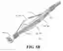 Fig. 07 - Method and deployable multi-spine apparatus for catheter-based renal denervation