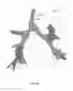 Fig. 07 - Registration with trajectory information with shape sensing