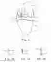 Fig. 04 - System and technique for accessing extra articular lesions or abnormalities or intra osseous lesions or bone marrow lesions