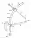 Fig. 01 - System and technique for accessing extra articular lesions or abnormalities or intra osseous lesions or bone marrow lesions