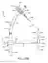 Fig. 22 - System and technique for accessing extra articular lesions or abnormalities or intra osseous lesions or bone marrow lesions
