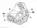 Fig. 01 - Dental surgery guide system