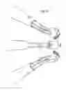 Fig. 20 - DENTAL INSTRUMENT FOR RESTORATIVE PROCEDURES