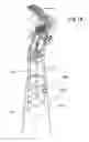 Fig. 22 - DENTAL INSTRUMENT FOR RESTORATIVE PROCEDURES