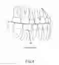 Fig. 07 - System and method for positioning three-dimensional brackets on teeth