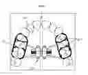 Fig. 01 - Palatal expansion appliance