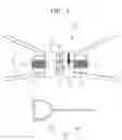 Fig. 02 - Palatal expansion appliance