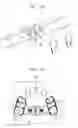 Fig. 05 - Palatal expansion appliance