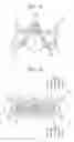 Fig. 06 - Palatal expansion appliance