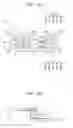 Fig. 11 - Palatal expansion appliance