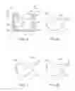 Fig. 04 - Adjustable-prescription orthodontic brackets