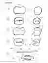 Fig. 04 - Direct dental bridge
