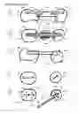 Fig. 05 - Direct dental bridge