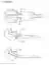 Fig. 23 - Direct dental bridge