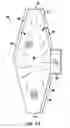 Fig. 06 - Dual end bellow prosthesis insertion device