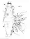 Fig. 09 - Dual end bellow prosthesis insertion device