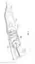 Fig. 04 - Peripheral vascular filtration systems and methods