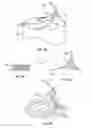 Fig. 09 - Peripheral vascular filtration systems and methods