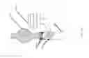 Fig. 191 - Aspiration devices and methods