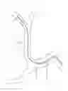 Fig. 236 - Aspiration devices and methods
