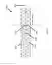 Fig. 31 - Aspiration devices and methods