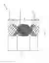 Fig. 44 - Aspiration devices and methods