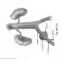 Fig. 63 - Aspiration devices and methods