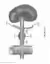 Fig. 64 - Aspiration devices and methods