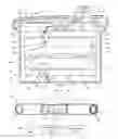 Fig. 01 - SYSTEM FOR CREATING A GRAFT DEVICE