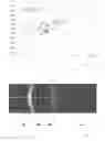 Fig. 04 - Method for selecting an IOL on the basis of the prediction of the anatomical, post-operative position and orientation thereof