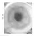 Fig. 100 - Prosthetic capsular devices, systems, and methods