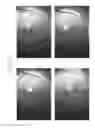 Fig. 103 - Prosthetic capsular devices, systems, and methods