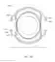 Fig. 121 - Prosthetic capsular devices, systems, and methods