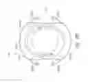 Fig. 162 - Prosthetic capsular devices, systems, and methods