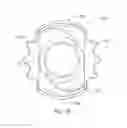 Fig. 20 - Prosthetic capsular devices, systems, and methods