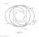 Fig. 30 - Prosthetic capsular devices, systems, and methods